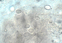 Giardien